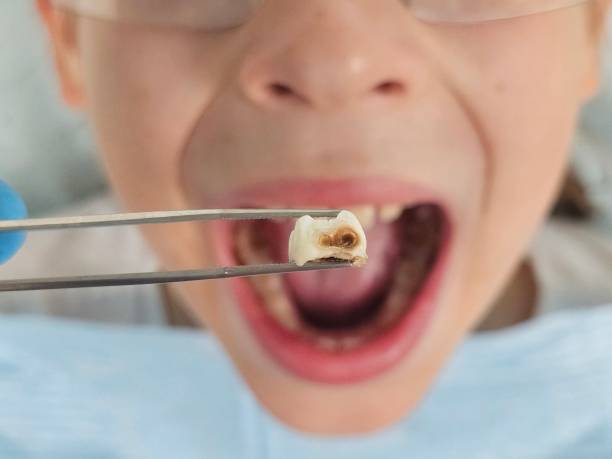 Best Pediatric Emergency Dentist in Manchester, TN